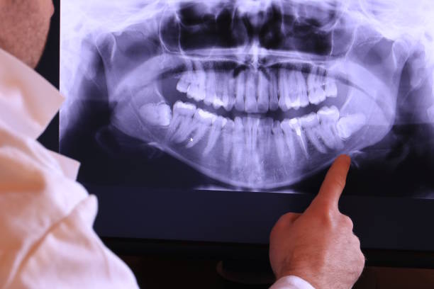 Best Emergency Gum Pain Relief  in North Beach Haven, NJ