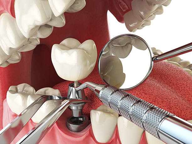 Best Urgent Tooth Repair  in North Beach Haven, NJ